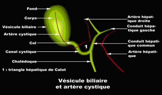 Cholécystite aiguë - Groupe Chirurgical Thiers